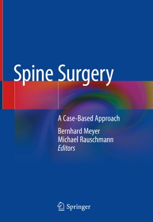 Spine Surgery | SpringerLink