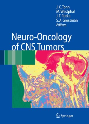 Neuro Oncology Of Cns Tumors Springerlink