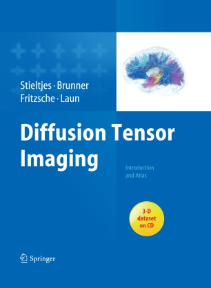 Diffusion Tensor Imaging Springerlink