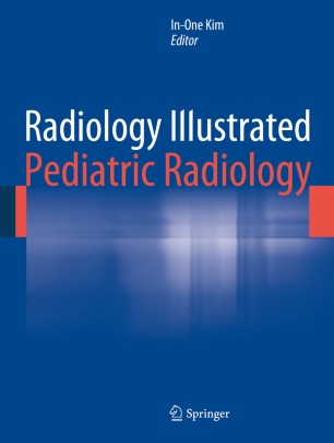 Radiology Illustrated Pediatric Radiology Springerlink