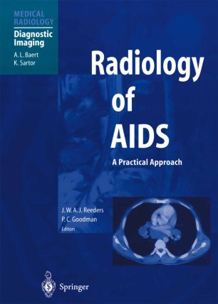 Radiology Of Aids Springerlink