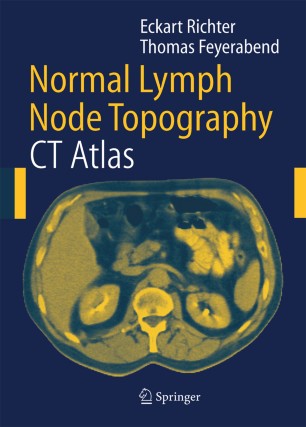 Normal Lymph Node Topography Springerlink