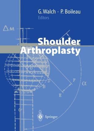Shoulder Arthroplasty Springerlink