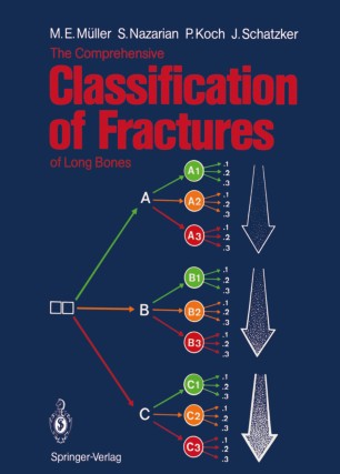 The Comprehensive Classification Of Fractures Of Long Bones Springerlink