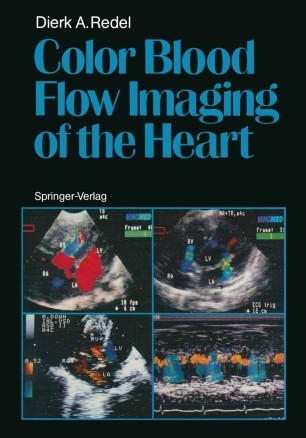 Color Blood Flow Imaging Of The Heart Springerlink