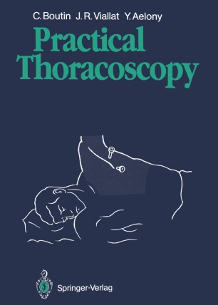 Thoracoscopy For Physicians A Practical Guide