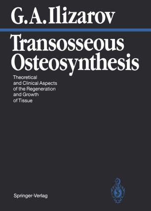 Transosseous osteosynthesis 03 picture