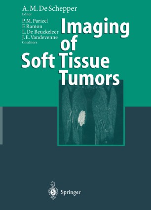 Imaging Of Soft Tissue Tumors Springerlink