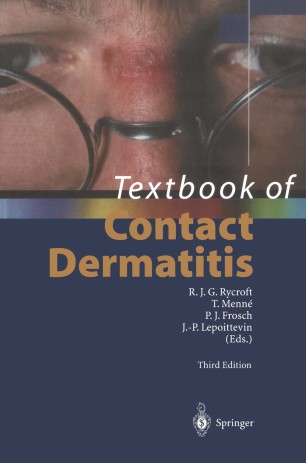 Textbook Of Contact Dermatitis Springerlink