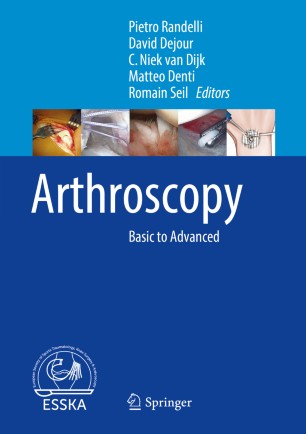 Arthroscopy | SpringerLink