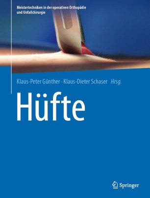 Front cover of Hüfte
