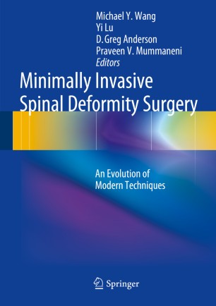 Minimally Invasive Spinal Deformity Surgery Springerlink