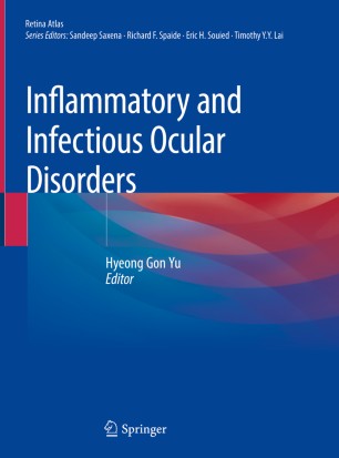 Inflammatory and Infectious Ocular Disorders  SpringerLink