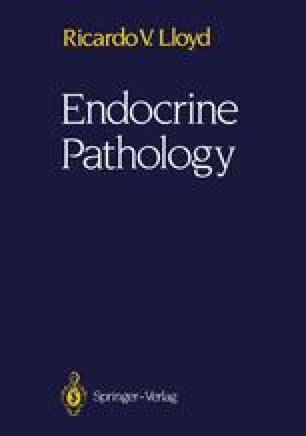 Extra Adrenal Paraganglion System Springerlink