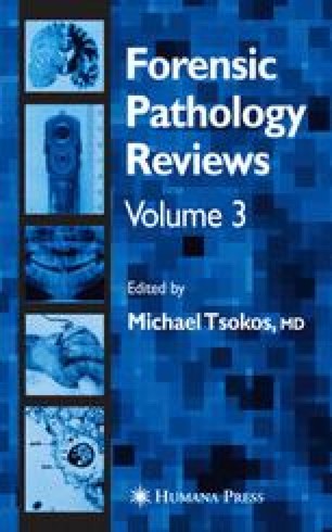 Knights Forensic Pathology Ebook