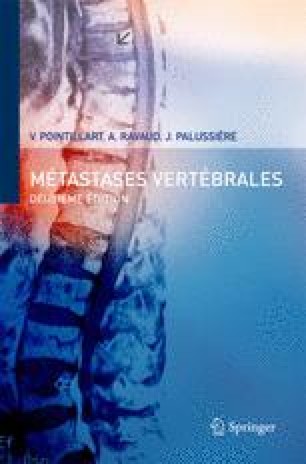 Metastases Osseuses Des Cancers Digestifs Springerlink