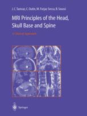 Brain And Skull Springerlink