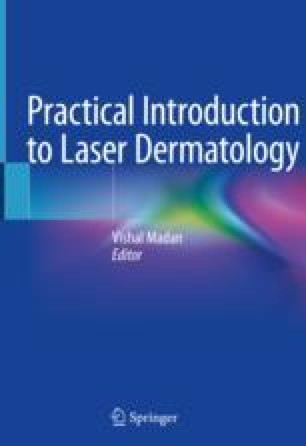 Practical Introduction to Laser Dermatology | SpringerLink