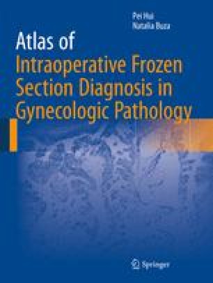 The Atlas And Cms Detectors Book Chapter Iopscience