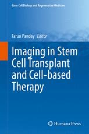 Uterine Stem Cells And Their Future Therapeutic Potential