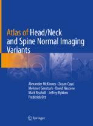sacral spine sacral spine