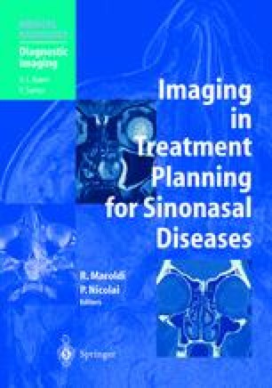 Ct And Mr Anatomy Of Paranasal Sinuses Key Elements Springerlink Ct And Mr Anatomy Of Paranasal Sinuses Key Elements Springerlink
