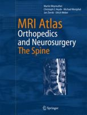 Degenerative Disorders Springerlink