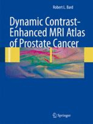 Nodal Cancer Perirectal And Pelvic Adenopathy Springerlink