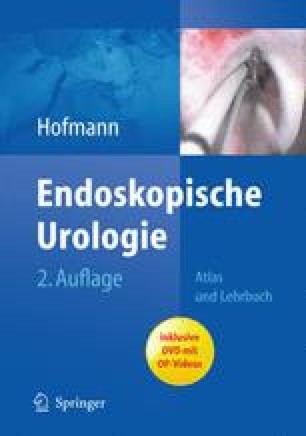 prostata urologie prostata urologie