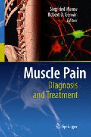 Myofascial Pain Syndrome | SpringerLink