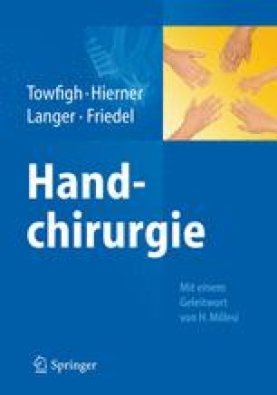 Therapie Des Komplexen Regionalen Schmerzsyndroms Crps I Aus Handtherapeutischer Sicht Springerlink