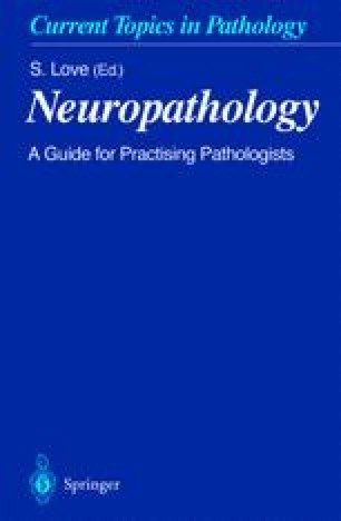 Head Injury In Routine And Forensic Pathological Practice Springerlink