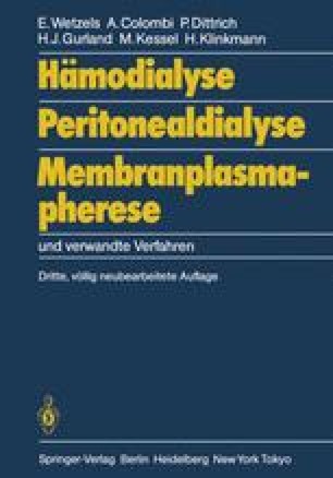 E book vor und nachteile