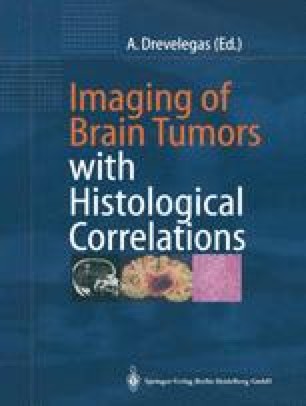 imaging brain tumors correlations histological