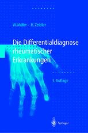 Gelenkschmerzen und Differentialdiagnose | SpringerLink