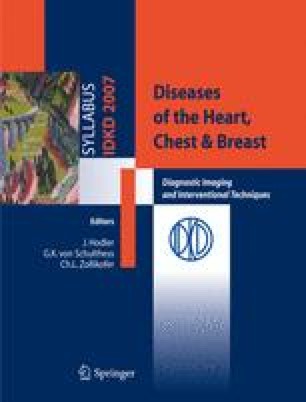 Pulmonary Manifestations Of Systemic Diseases Springerlink - 