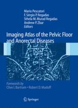 Cinedefecography In Functional Pelvic Floor Disorders Springerlink