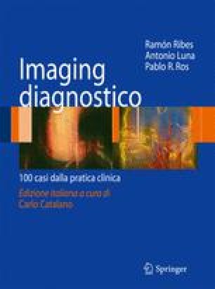 Imaging Dellapparato Gastrointestinale E Patologie Di