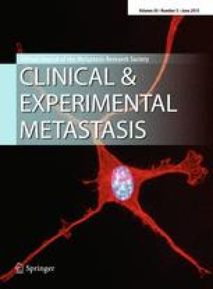 Bone Metastasis: Experimental and Clinical Therapeutics