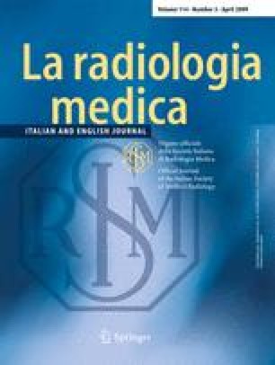 diffusione agenesia diffusione agenesia