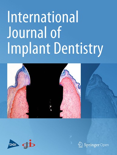 International Journal of Implant Dentistry - Cover