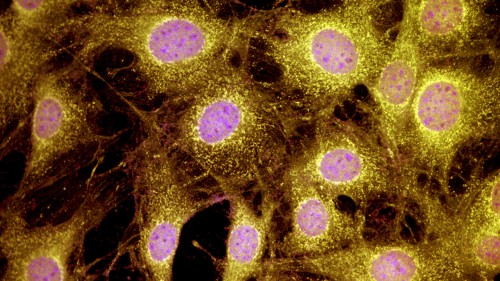 Mechanotransduction