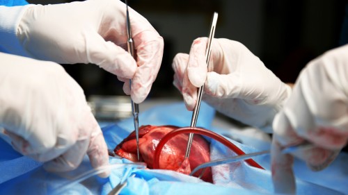 Atlas of Organ Transplantation (DVDなし） Table of Contents page: American Journal of Transplantation