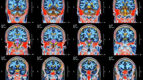 Machine learning applications in medical image analysis