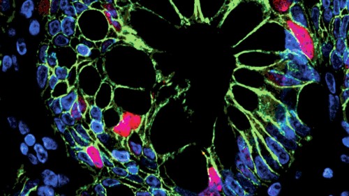 Stem cells from development to the clinic