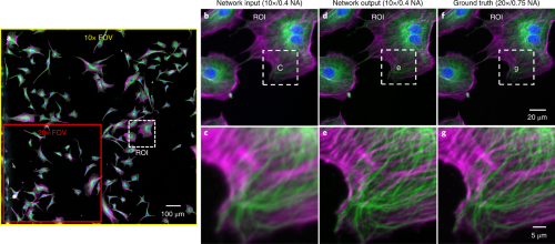Deep-learning-based super-resolved images of bovine pulmonary artery endothelial cells (BPAECs).