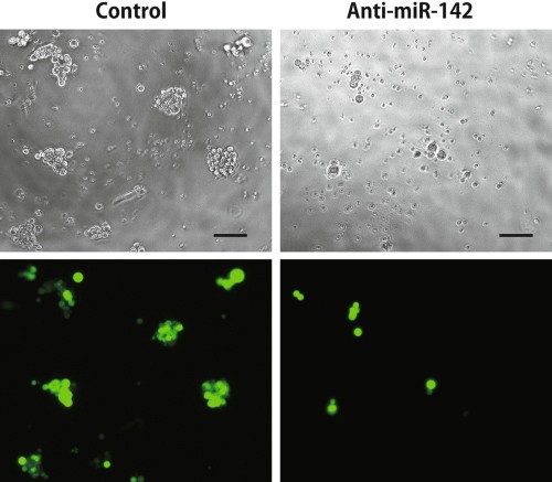 Suppression of organoid formation by microRNA-expressing lentivirus.