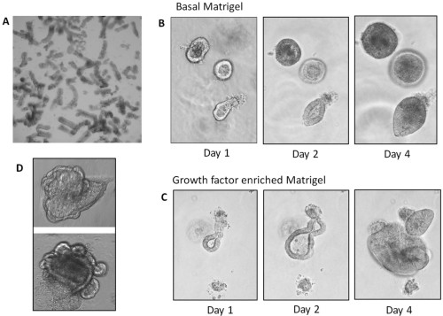 Crypts and organoids at various stages during isolation and growth.