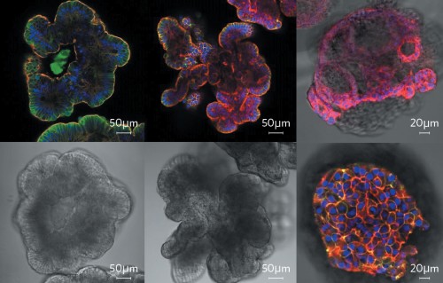 A comprehensive approach to cancer