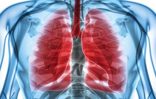 Lung cancer is a priority